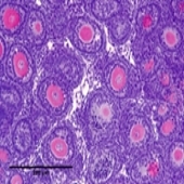 Mouse ovarian histological section immunostained with an oocyte-specific marker MSY-2 (red)